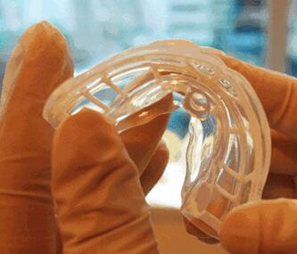 兒童牙齒矯正貴不貴？南通摩爾口腔六月MRC牙齒矯治5680元