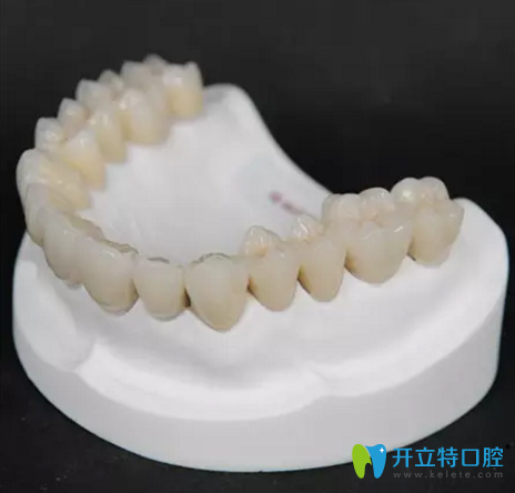 牙博士烤瓷牙修復(fù)