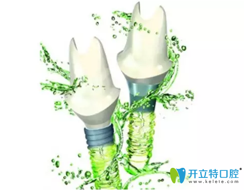 鄭州森德口腔采用瑞士ITI種植體 鄭州森德口腔采用瑞士ITI種植體