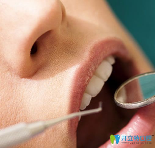 你說洗牙會讓牙齒變松 立勤口腔整理洗牙前需要了解5個問題