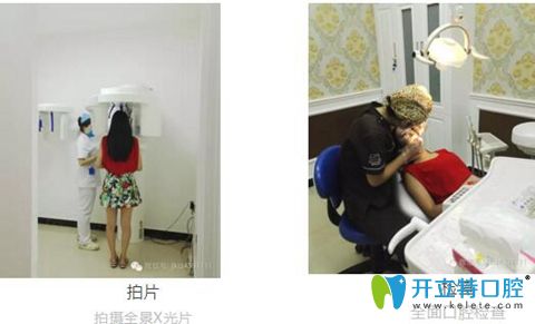 在揚州菲特口腔體驗超聲波潔牙 洗牙并沒想象中那么疼