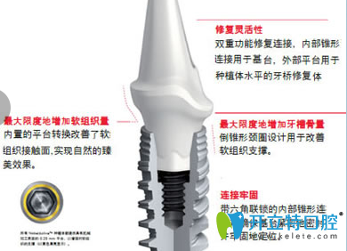 牙齒缺失危害大 咸陽小白兔口腔5大牙齒種植體幫你解決