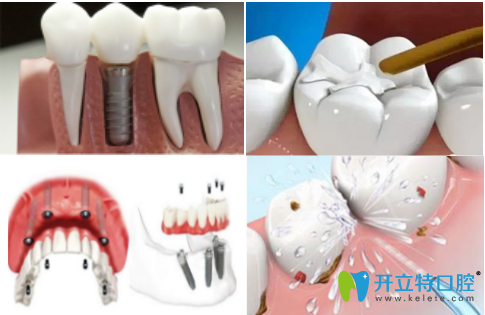 洛陽維樂口腔門診部宣傳圖