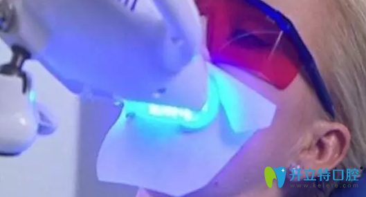 牙齒發(fā)黃不好看？咸陽三秦口腔冷光美白還你亮齒白
