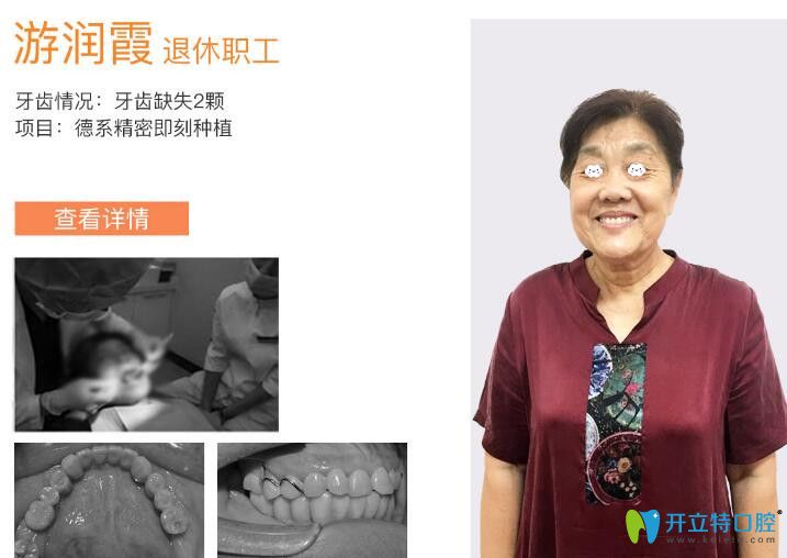 圣潔口腔牙齒缺失精密種植案例 圣潔口腔牙齒缺失精密種植案例