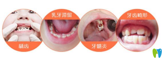兒童的牙齒問(wèn)題