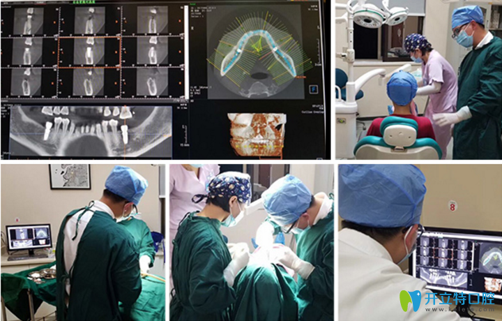 致美種植牙的過程