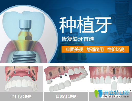 牙齒缺失說話漏風(fēng)？德陽(yáng)新橋口腔種植牙幫你改善缺牙問題