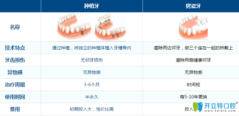 德陽新橋口腔種植牙優(yōu)勢