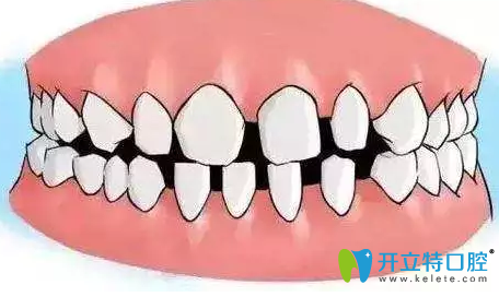 徐州博愛口腔牙頜畸形示意圖