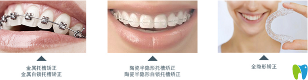 郴州植貝爾口腔三大牙齒矯正器 郴州植貝爾口腔三大牙齒矯正器