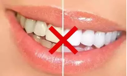 洗牙和牙齒美白一樣嗎 孝感口腔解析美白牙齒的方法有哪些