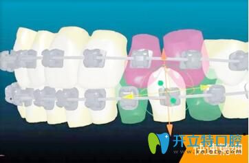 烏魯木齊美奧口腔門診數(shù)字化矯正系統(tǒng)更精準(zhǔn)