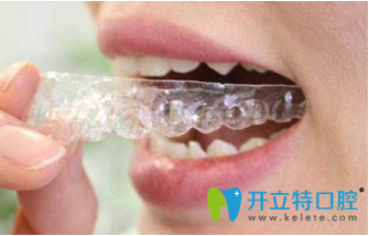 洛陽維樂口腔牙齒矯正宣傳圖