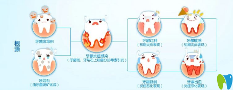 患有牙周病的人平時(shí)應(yīng)注意些什么？