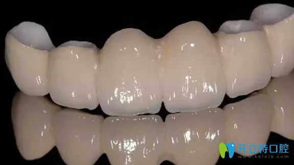 全瓷牙對牙釉質磨損較小 全瓷牙對牙釉質磨損較小
