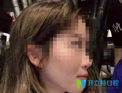 沒想到效果真的很好，我很感謝西安諾貝爾