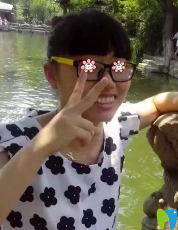 去沈陽(yáng)愛齒口腔矯正前的我