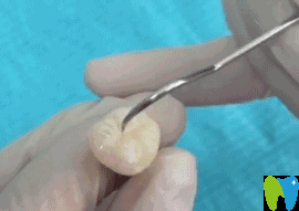 用尖銳的探針進(jìn)行全面檢查