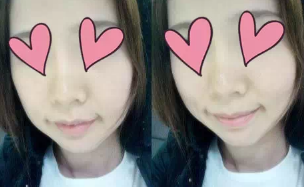 西安藝星口腔科牙齒矯正分享，是為了給牙齒變一場魔術