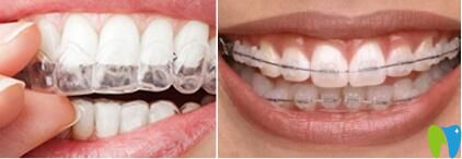 長沙美萊口腔牙齒矯正優(yōu)惠