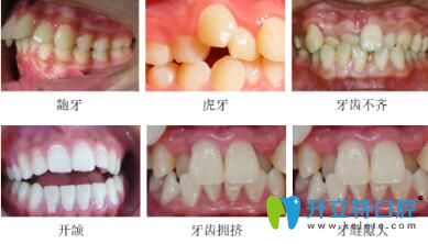 長沙美萊口腔牙齒矯正不設(shè)年齡，讓您洋溢燦爛的笑容