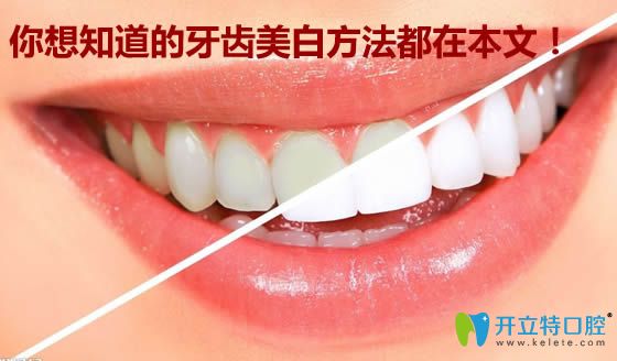 想了解牙齒美白的小竅門(mén),有關(guān)牙黃變白的祖?zhèn)鞣椒ǘ荚谶@里
