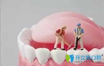 種植牙的壽命維持更長時(shí)間的小竅門 種植牙的壽命維持更長時(shí)間的小竅門