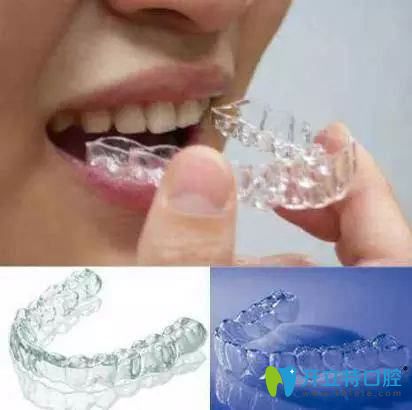 白山欣美口腔診所隱形牙齒矯正 白山欣美口腔診所隱形牙齒矯正