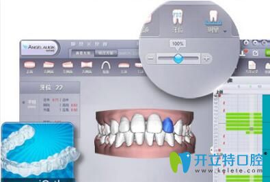 長沙美萊口腔可視效果評估