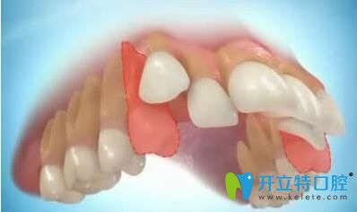 欽州康美牙齒矯正