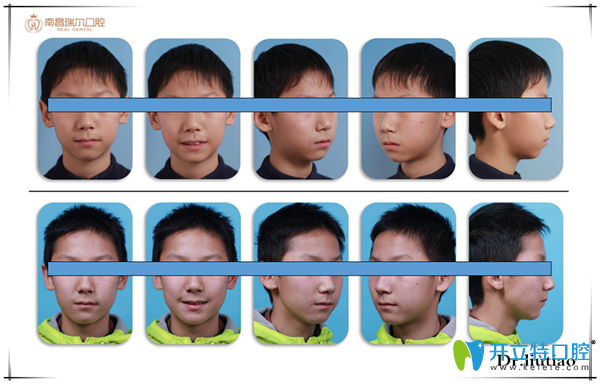 擁擠，單純排齊