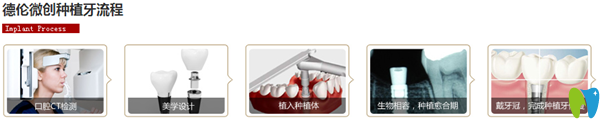 瑞爾口腔種植牙的簡(jiǎn)單流程圖
