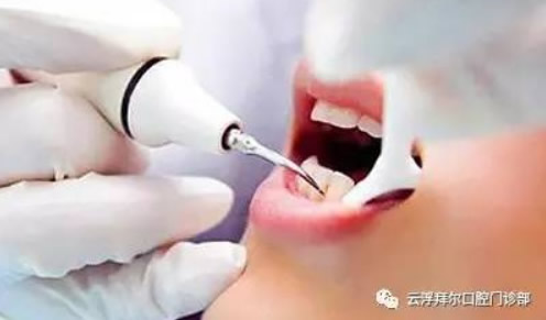 害怕拔牙怎么辦 云浮拜爾口腔微創(chuàng)無(wú)痛拔牙幫你克服恐懼癥