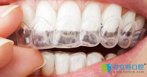 北京科瓦齒科貴嗎?老顧客親測(cè):幾千塊種牙+德國(guó)技術(shù)真不坑