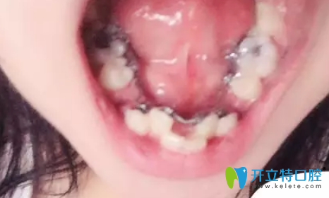 在深圳格倫菲爾（唐?。┛谇话窝绖偞餮捞? width=