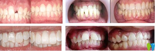 拜博口腔牙齒種植、牙齒矯正及牙齒美容修復(fù)<span style=