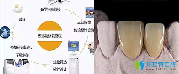 威海貝麗口腔修復(fù)制作牙齒案例圖