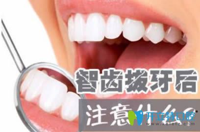 拔了智齒后要注意什么事項(xiàng)？深圳麥牙口腔的鄭蒼尚來解答