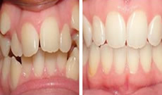 深圳諾德齒科價(jià)格怎么樣？看牙后顧客反饋性價(jià)比高