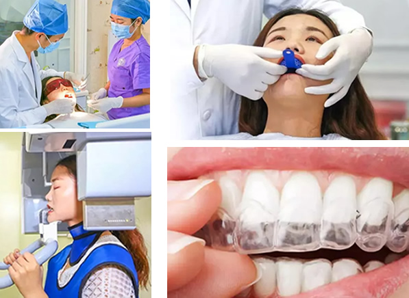 我被深圳太平洋口腔免費(fèi)試戴隱形牙套矯正牙齒活動(dòng)選中了