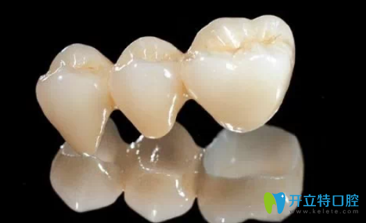 二氧化鋯全瓷牙價格是多少？深圳汪洋齒科吳健雄揭秘啦