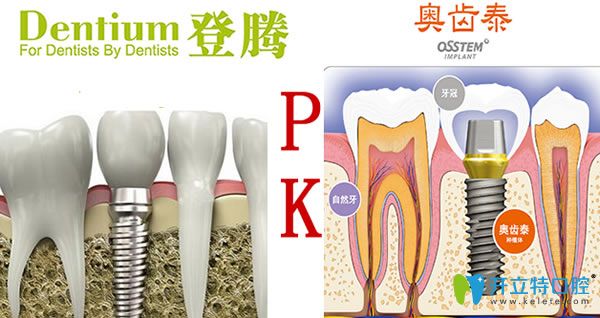 韓國登騰和奧齒泰哪個更好？兩個種植體優(yōu)劣對比(2024新版)