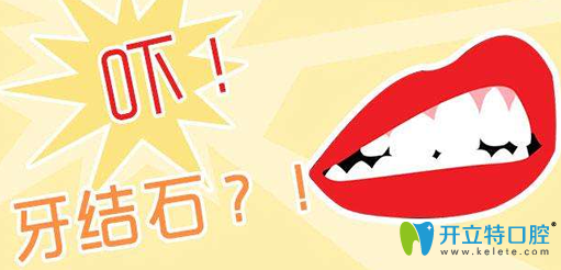 牙結(jié)石除了洗牙能去掉還有八大清除牙結(jié)石小竅門(mén)可參考喲