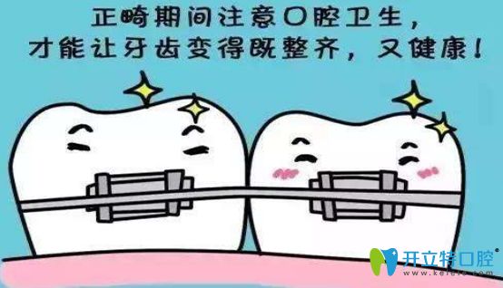 詳解牙齒矯正期間的飲食注意事項 讓你避開這7個錯誤習慣