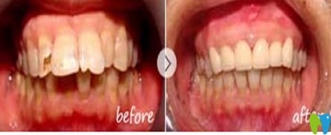 廣州雅皓王臻醫(yī)師牙齒矯正圖片