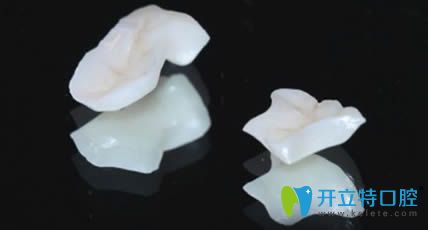 DSD微笑美學(xué)修復(fù)所使用的材料