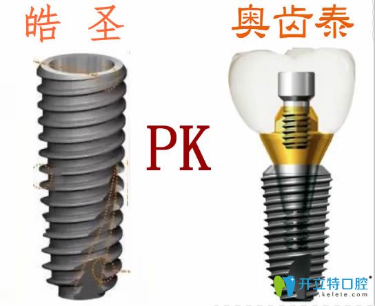 美國皓圣和韓國奧齒泰哪個種植體好？價格及使用壽命大PK