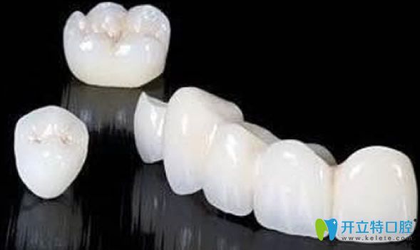 門(mén)牙有縫隙建議戴烤瓷牙