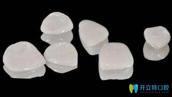牙貼面是專(zhuān)門(mén)修復(fù)牙縫大的方法